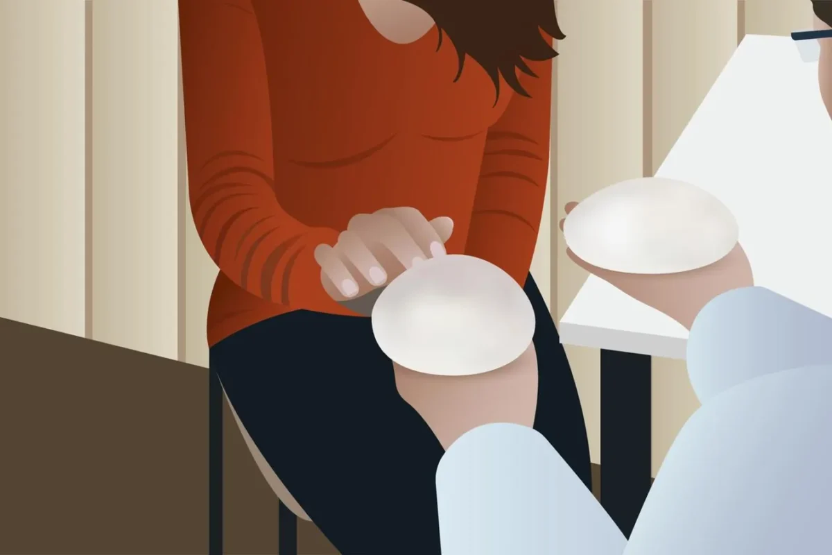 Saline Implants